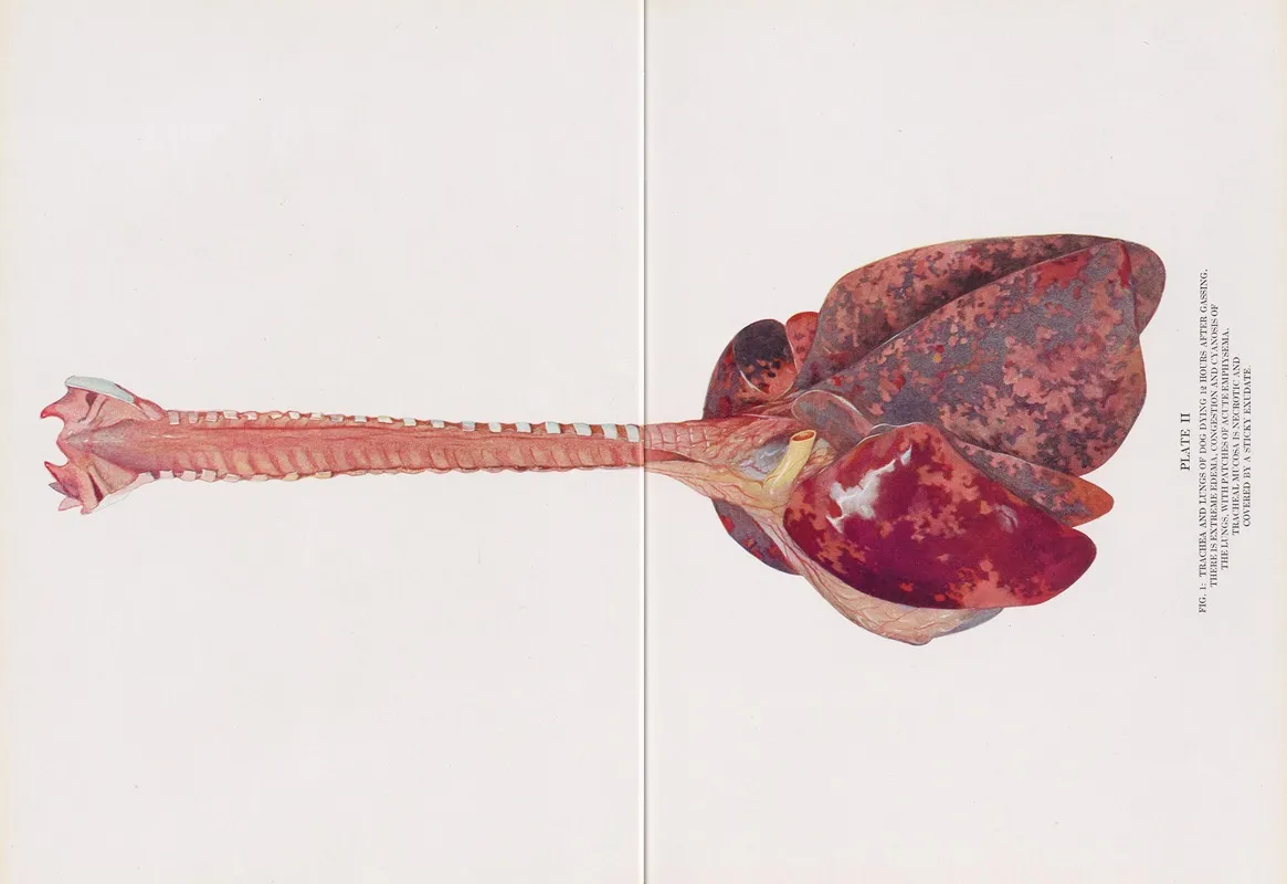 Plate Ii Fig 1 Trachea And Lungs Of Dog Dying 12 Hours After Gassing by Milton C. Winternitz - Canvas Print