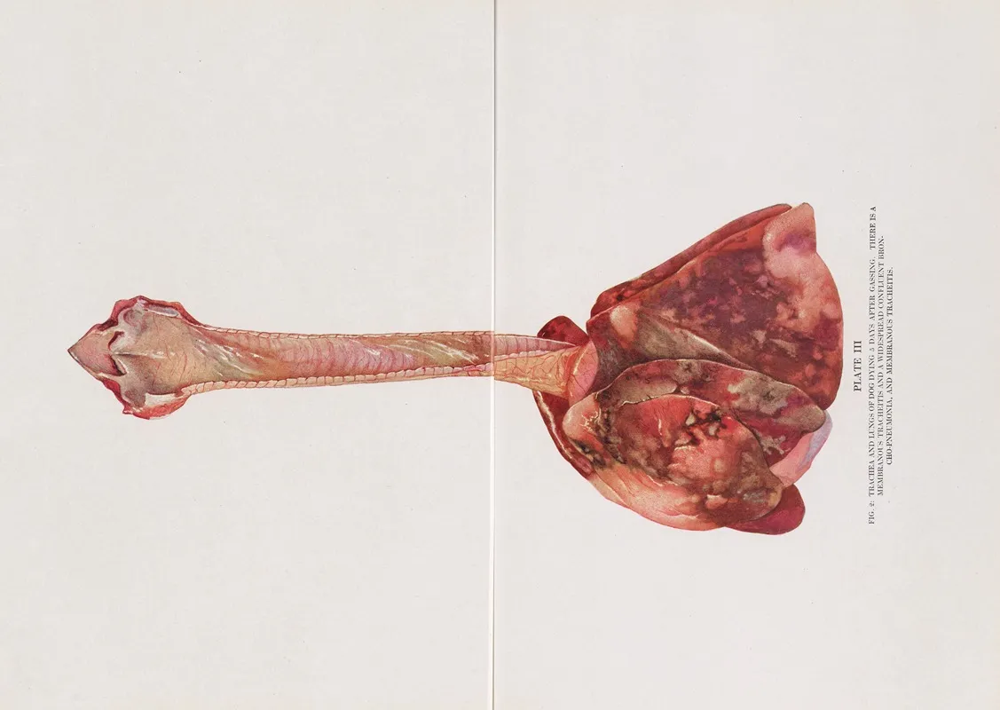Plate Iii Fig 2 Trachea And Lungs Of Dog Dying 5 Days After Gassing by Milton C. Winternitz - Canvas Print