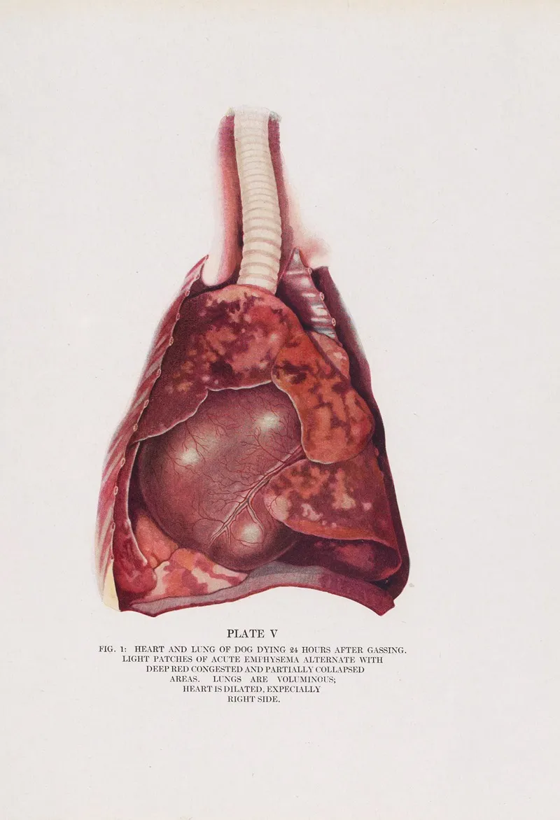 Plate V Fig 1 Heart And Lung Of Dog Dying 24 Hours After Gassing by Milton C. Winternitz - Canvas Print