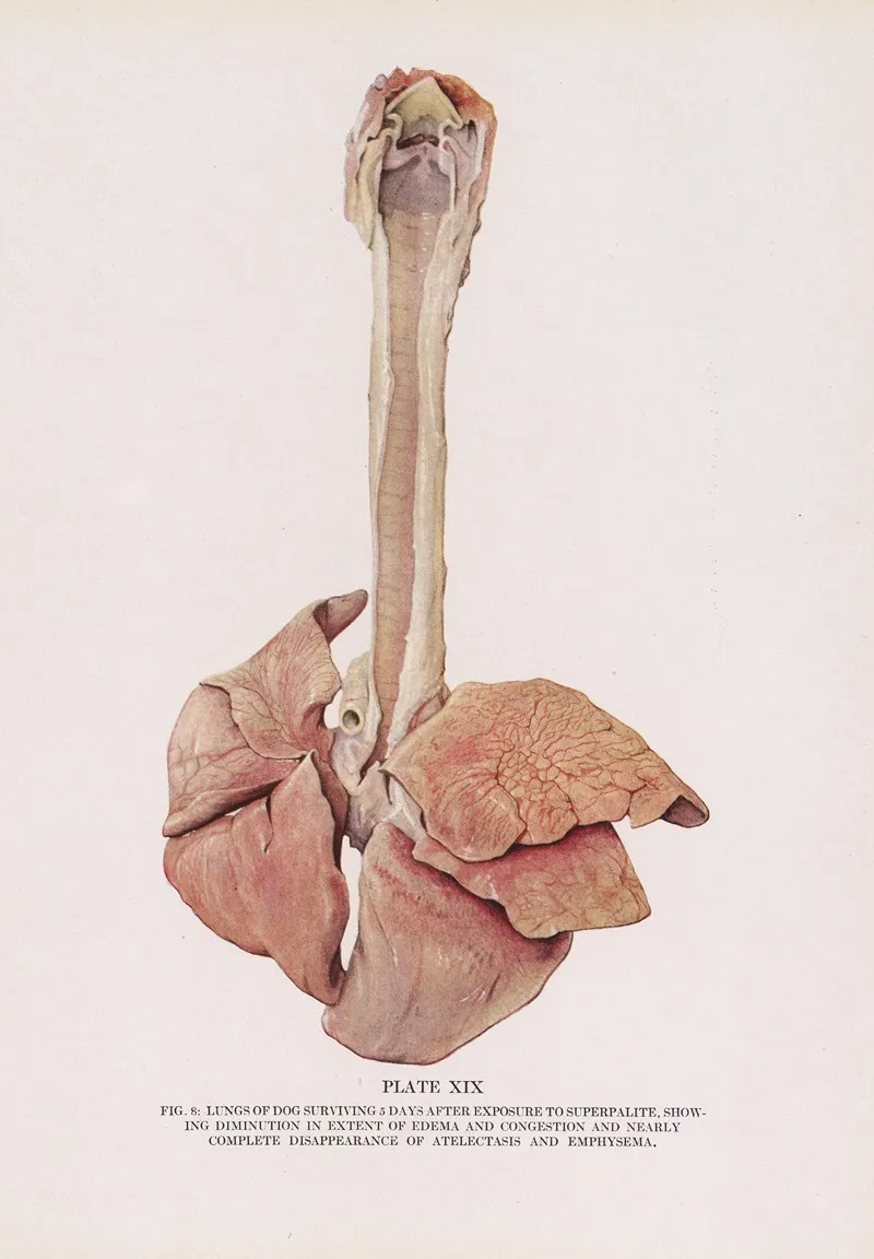 Plate Xix Fig 8 Lungs Of Dog Surviving 5 Days After Exposure To Superpalite Showing Diminution In Extent Of Edema And Congestion And Nearly Complete Disappearance Of Atelectasis And Emphysema by Milton C. Winternitz - Canvas Print