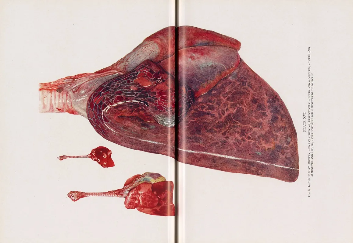 Plate Xvi Fig 1 Lungs Of Goat Monkey And Rat Surviving Respectively 4 Hours And 10 Minutes 4 Hours And 55 Minutes And 6 Hours After Exposure For 15 Minutes To Chlorpicrin by Milton C. Winternitz - Canvas Print