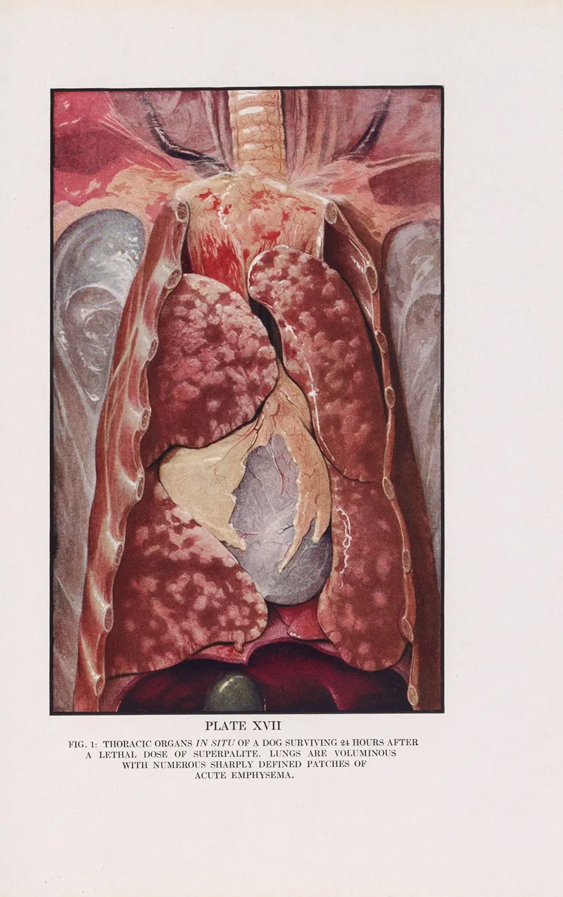 Plate Xvii Fig 1 Thoracic Organs In Situ Of A Dog Surviving 24 Hours After A Lethal Dose Of Superpalite by Milton C. Winternitz - Canvas Print