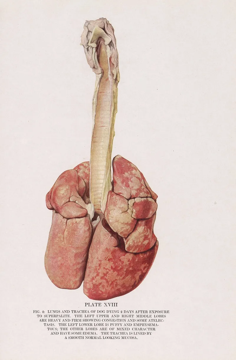 Plate Xviii Fig 2 Lungs And Trachea Of Dog Dying 2 Days After Exposure To Superpalite by Milton C. Winternitz - Canvas Print