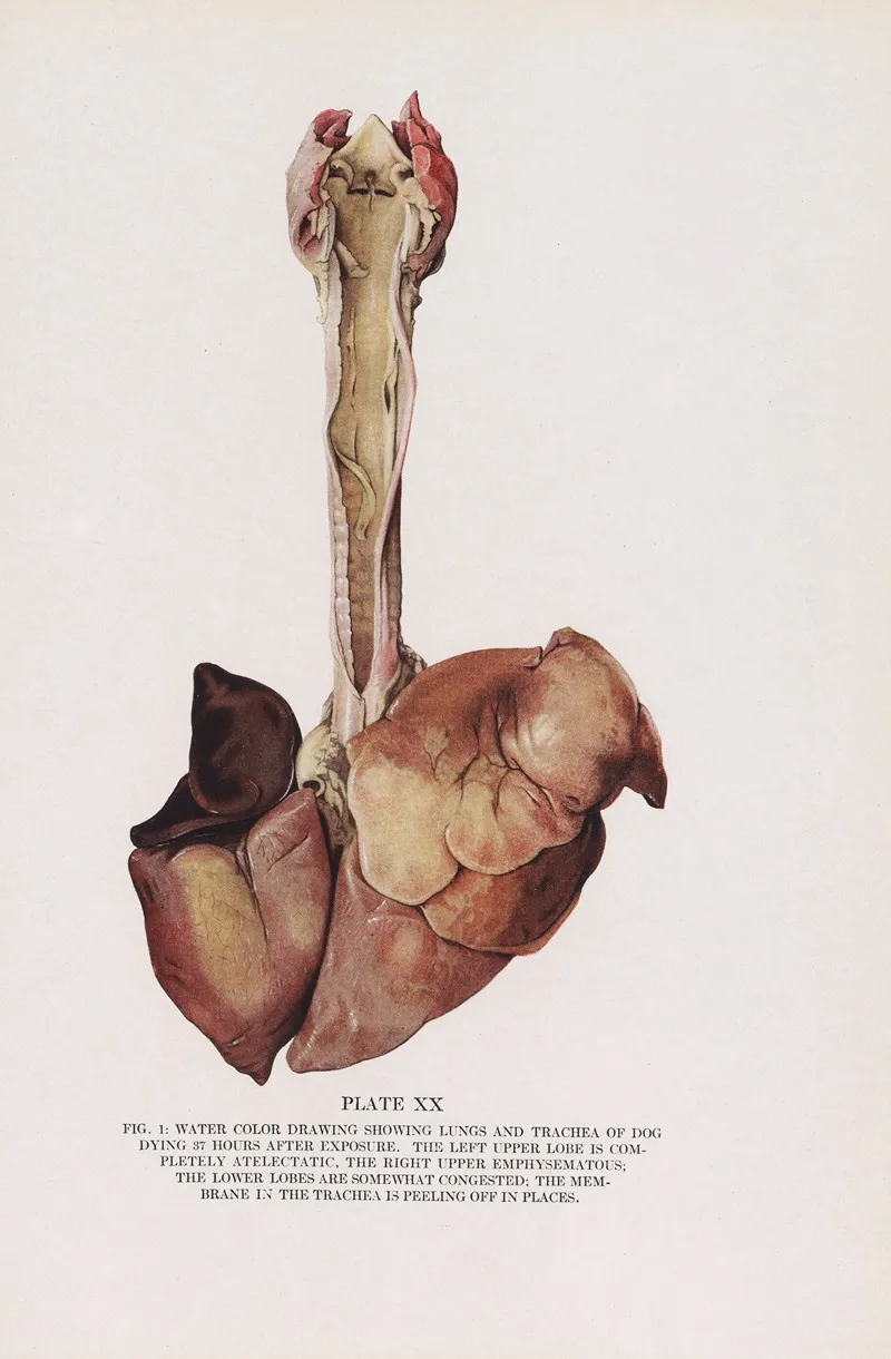 Plate Xx Fig 1 Water Color Drawing Showing Lungs And Trachea Of Dog Dying 37 Hours After Exposure by Milton C. Winternitz - Canvas Print