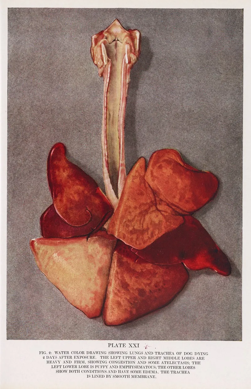 Plate Xxi Fig 2 Water Color Drawing Showing Lungs And Trachea Of Dog Dying 2 Days After Exposure by Milton C. Winternitz - Canvas Print