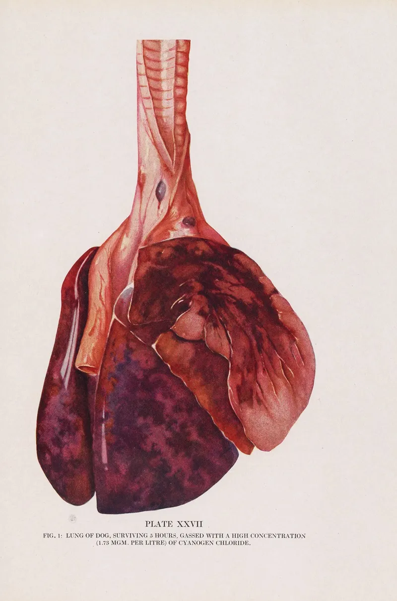 Plate Xxvii Fig 1 Lungs Of Dog Surviving 5 Hours Gassed With A High Concentration Of Cyanogen Chloride by Milton C. Winternitz - Canvas Print