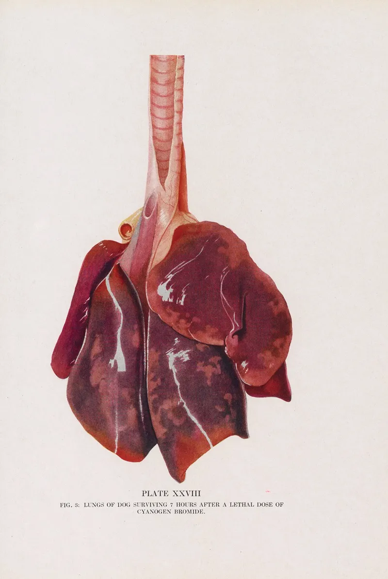 Plate Xxviii Fig 3 Lungs Of Dog Surviving 7 Hours After A Lethal Dose Of Cyanogen Bromide by Milton C. Winternitz - Canvas Print