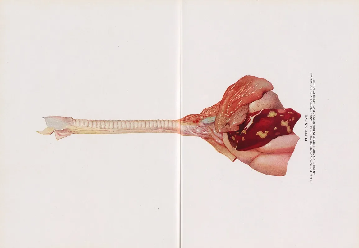 Plate Xxxvii Fig 6 Pneumonia Confined To One Lobe And Appearing As Large Yellow Abscesses On The Surface In Dog Dying 5 Days After Exposure by Milton C. Winternitz - Canvas Print
