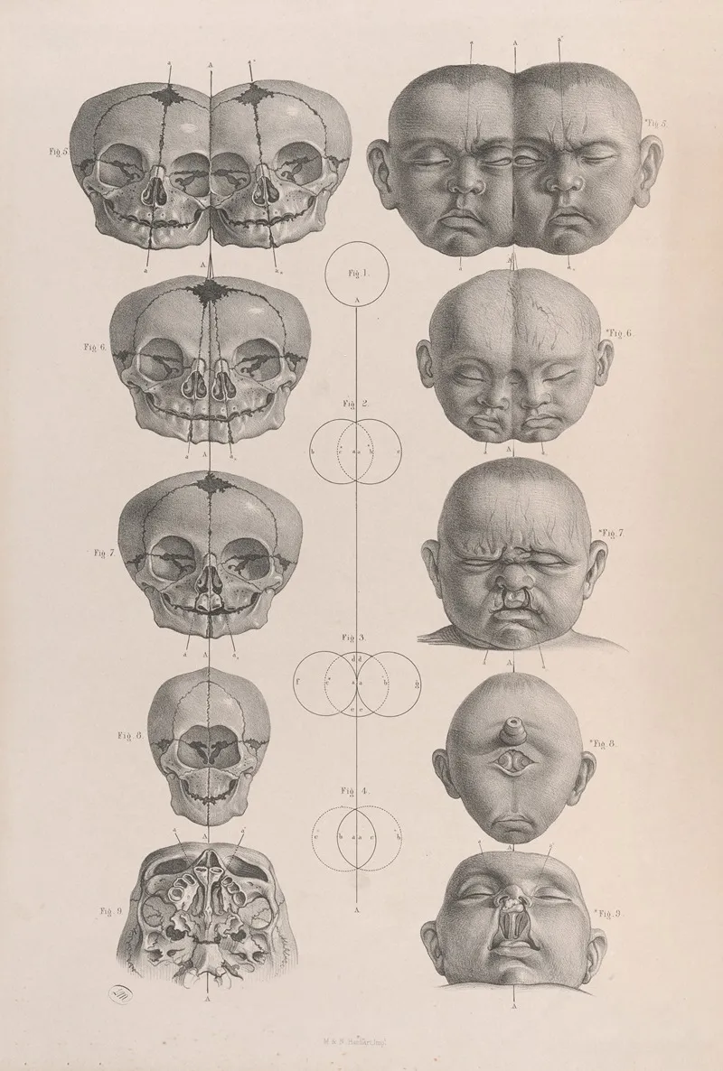 Surgical Anatomy Pl 19 by Joseph Maclise - Canvas Print
