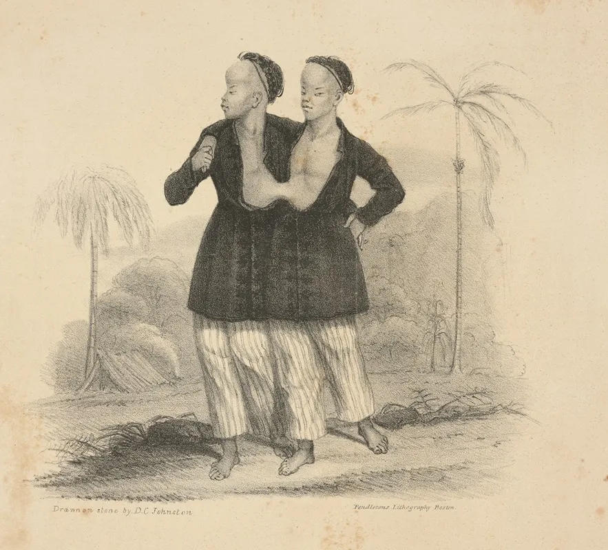 The Siamese Boys Aged 18