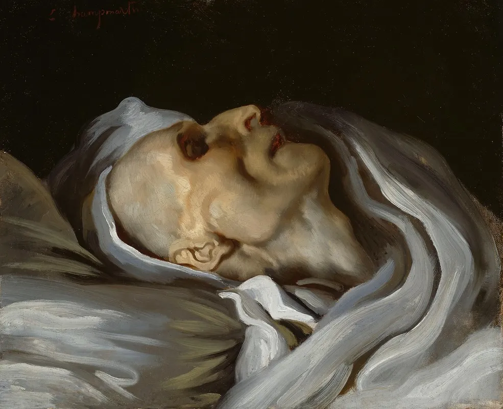 Theodore Gericault On His Deathbed