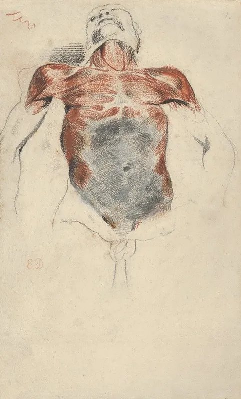 Torso Of A Male Cadaver